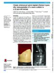 Chronic enterococcal spinal implant infection 6 years after instrumentation of a severe scoliosis in a 22-year-old woman